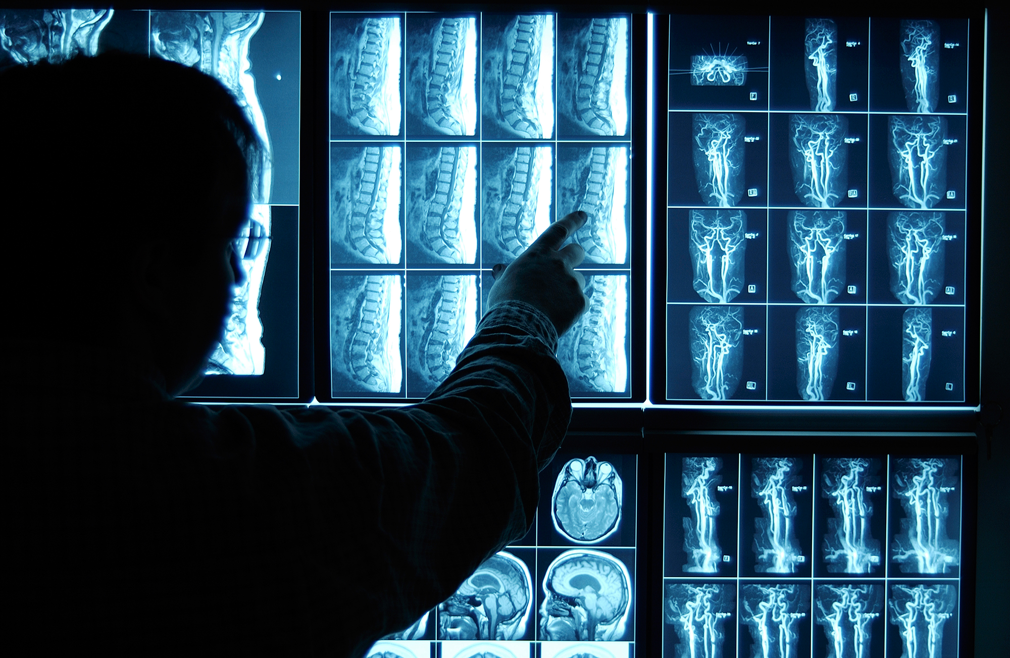 xray 1357h0019